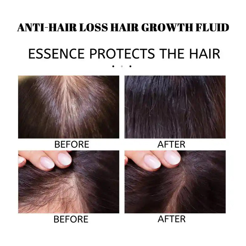 Rosemary Mint Strengthening Hair Oil