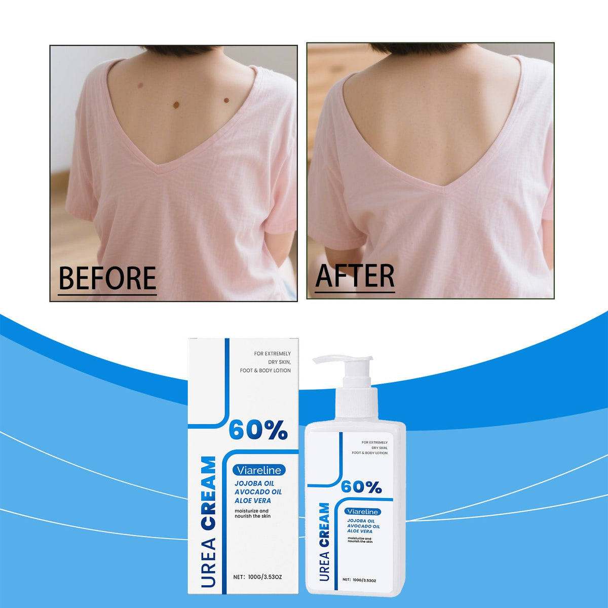 Intensive Urea Body Cream